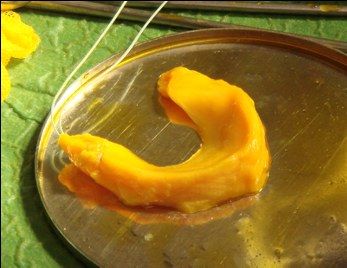 Trapianto meniscale: preparazione dell’innesto