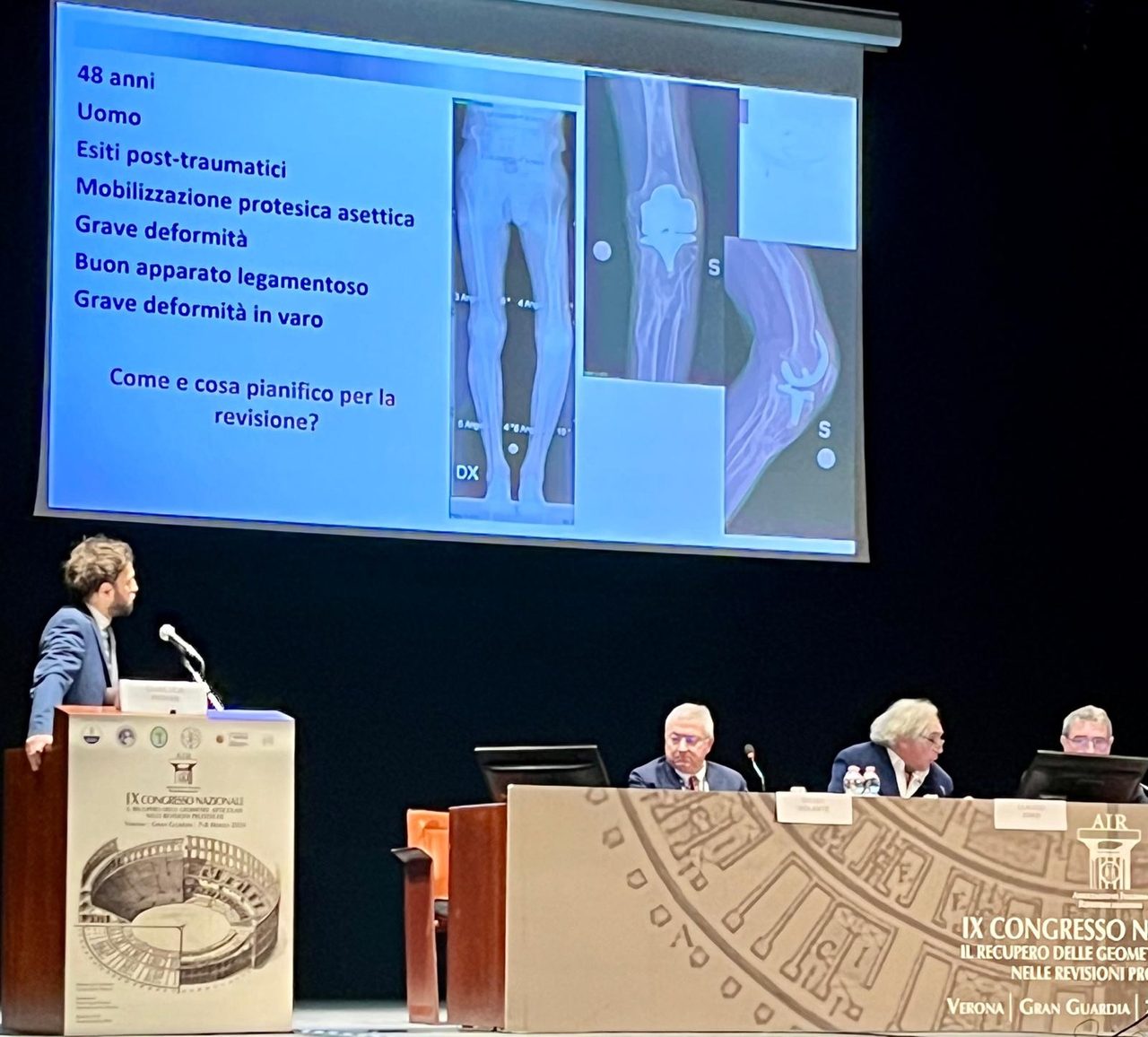 Dott. Gianluca Piovan durante una relazione al IX Congresso Nazionale sul recupero delle geometrie articolari nelle revisioni protesiche, Verona